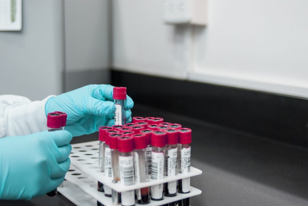 A lab technician holding vials of blood to do blood testing, Theranos Scandal.