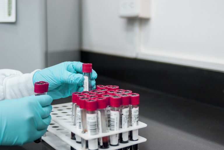 A lab technician holding vials of blood to do blood testing, Theranos Scandal.